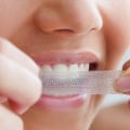 How to Whiten Your Teeth Naturally and Safely