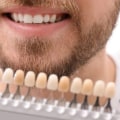 How Long Does Teeth Whitening Last?