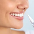 The Best Teeth Whitening Products for a Brighter Smile