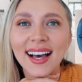 Is Professional Teeth Whitening Worth It?