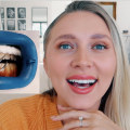 Does Teeth Whitening Damage Your Teeth?