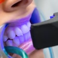 Does Teeth Whitening Make Your Teeth Weaker?