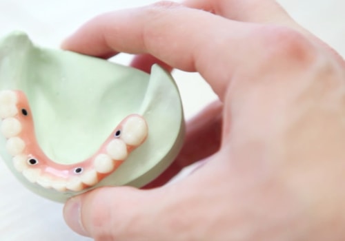 Who Should Not Get Their Teeth Whitened?
