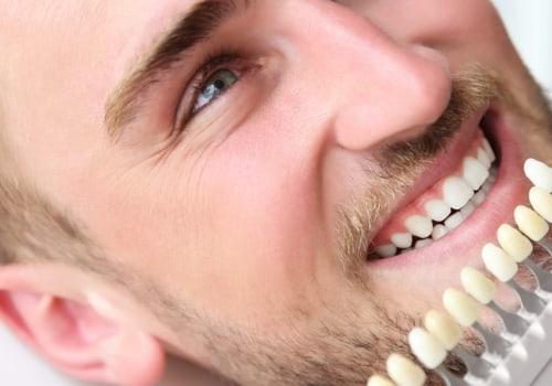 Is Teeth Whitening Safe and Healthy?