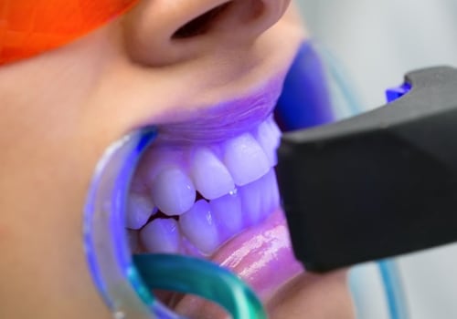 Does Teeth Whitening Make Your Teeth Weaker?